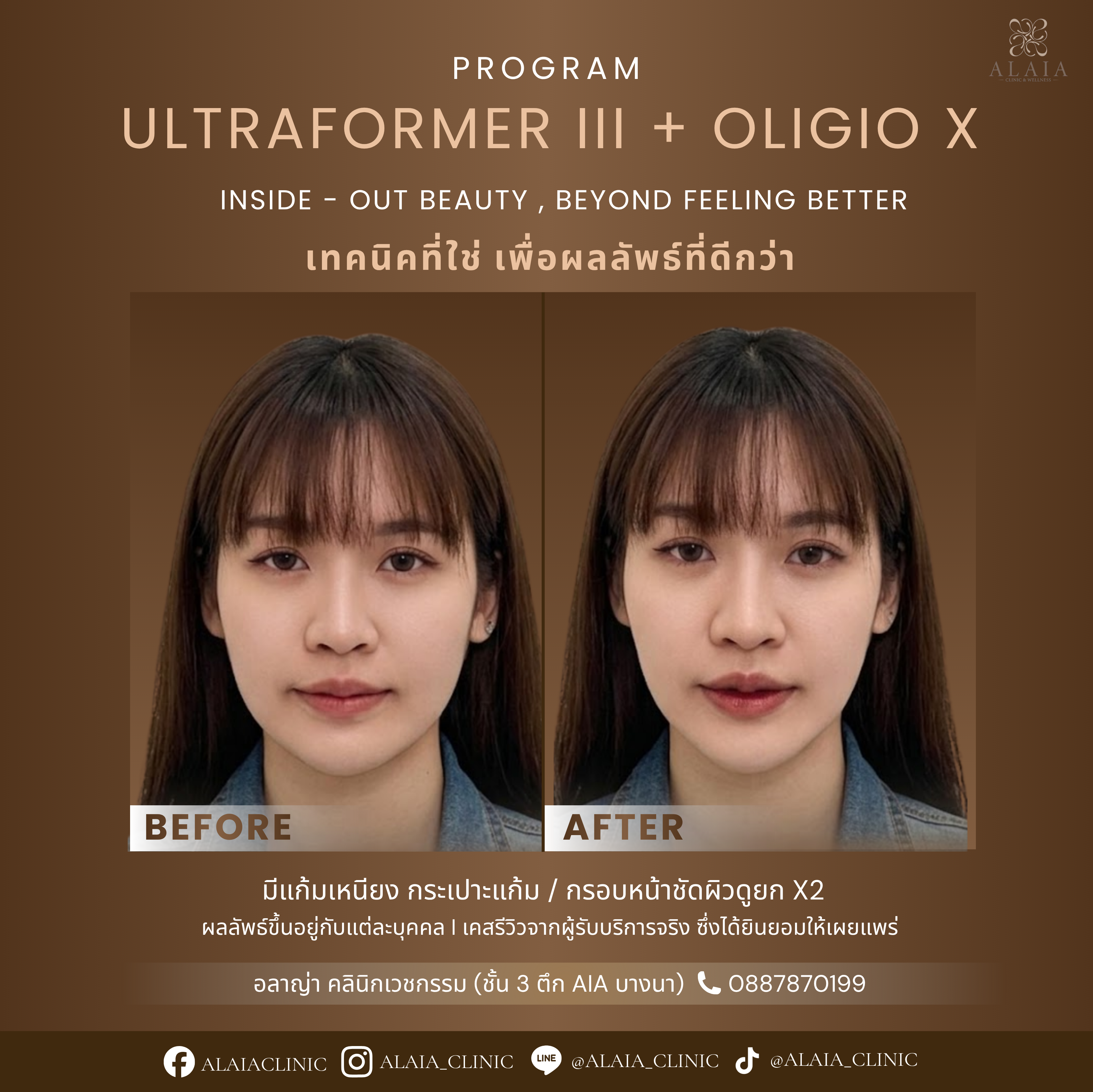 B&A 6